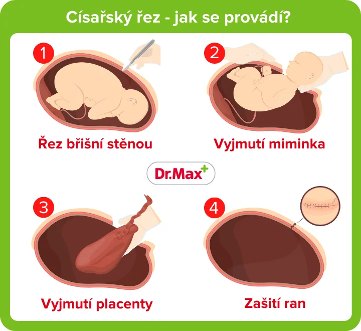 Jak dlouho trva než dojde eRecept?