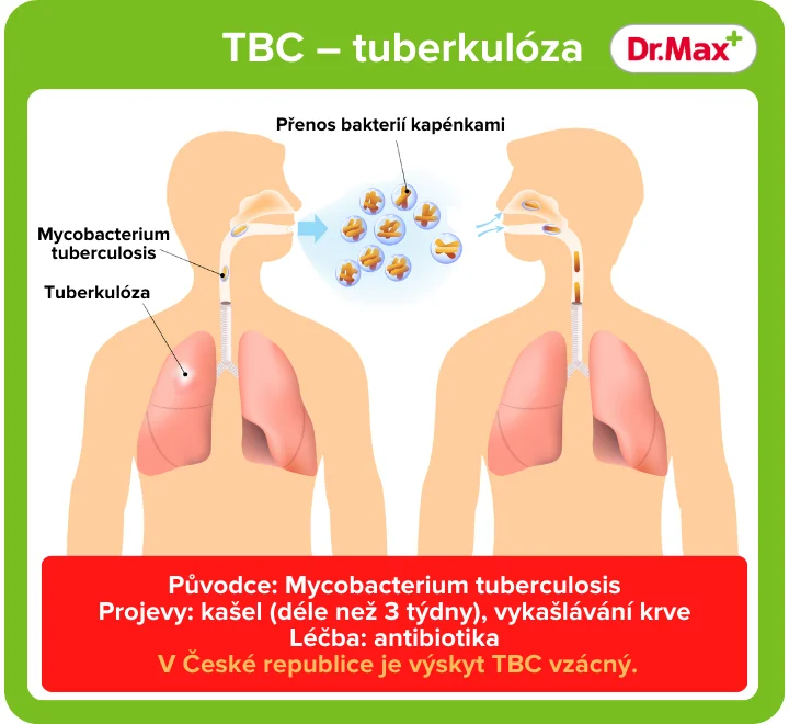 Jak se diagnostikuje tuberkulóza?