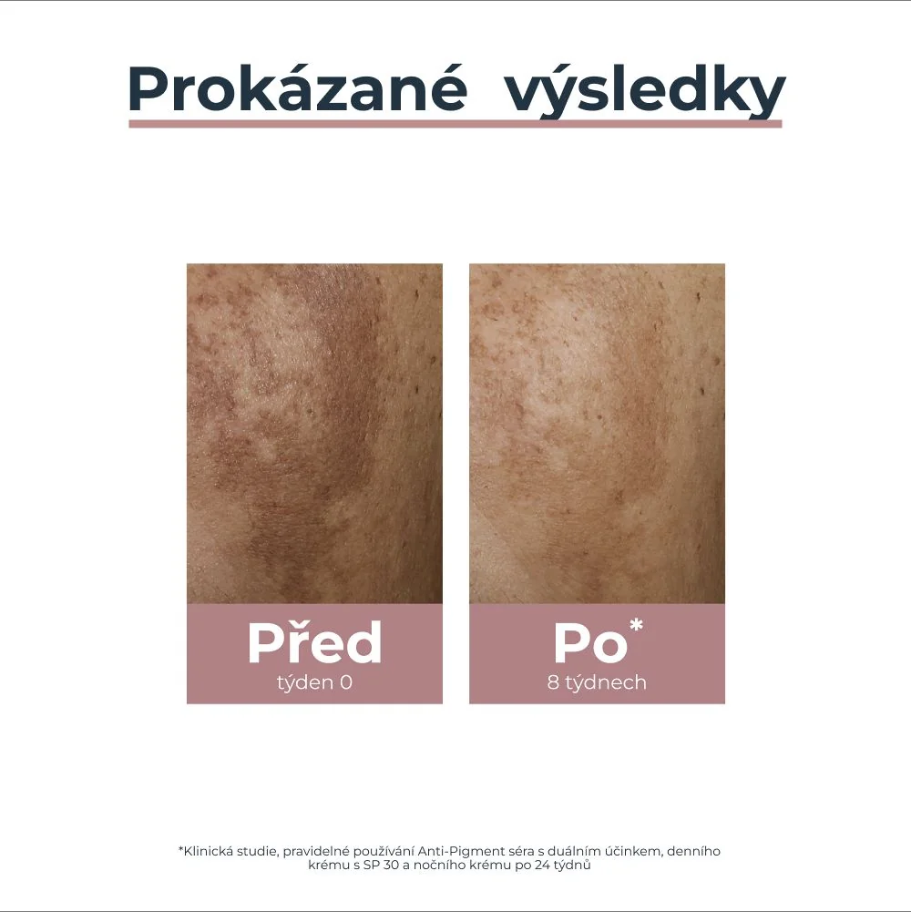 Eucerin AntiPigment noční krém proti pigmentovým skvrnám 50 ml