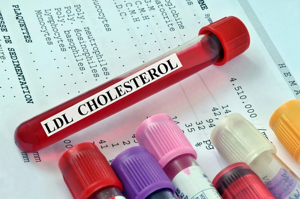 Vysoký cholesterol – příznaky, léčba a jeho snížení