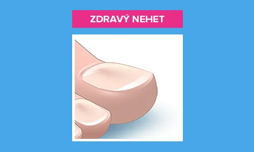 Zdravý nehet