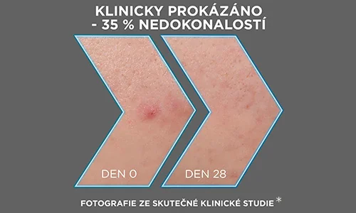 výsledky klinické studie po 28 dnech používání