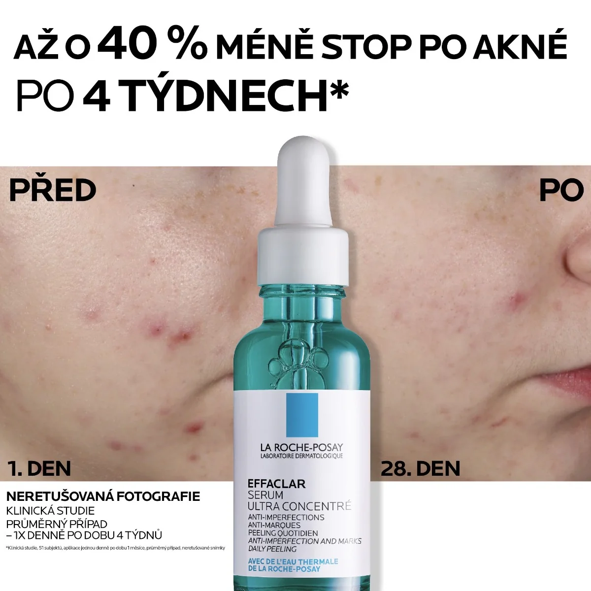 La Roche-Posay Effaclar Ultra koncentrované sérum 30 ml