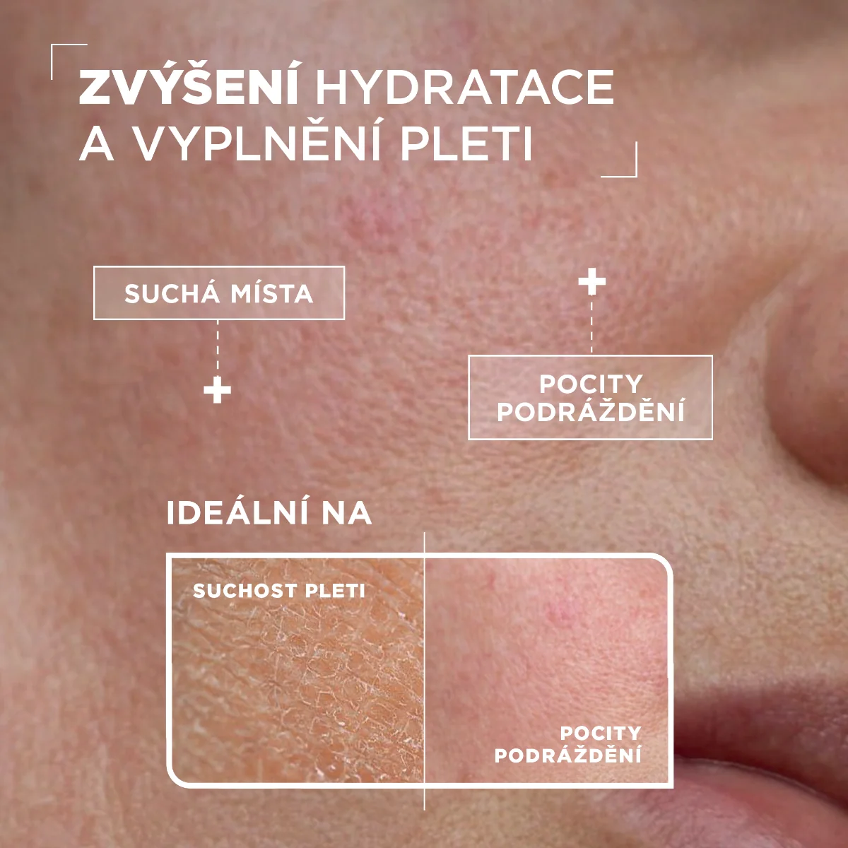 Mixa Face & Cleansing Hydratační sérum proti vysušení 30 ml